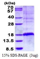 Human TSC22D3 / GILZ Protein (Recombinant His)