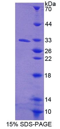 Mouse ABCB10 Protein (Recombinant His-T7, N-terminus)