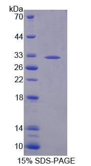 Human B3GAT2 Protein (Recombinant His, N-Terminal)
