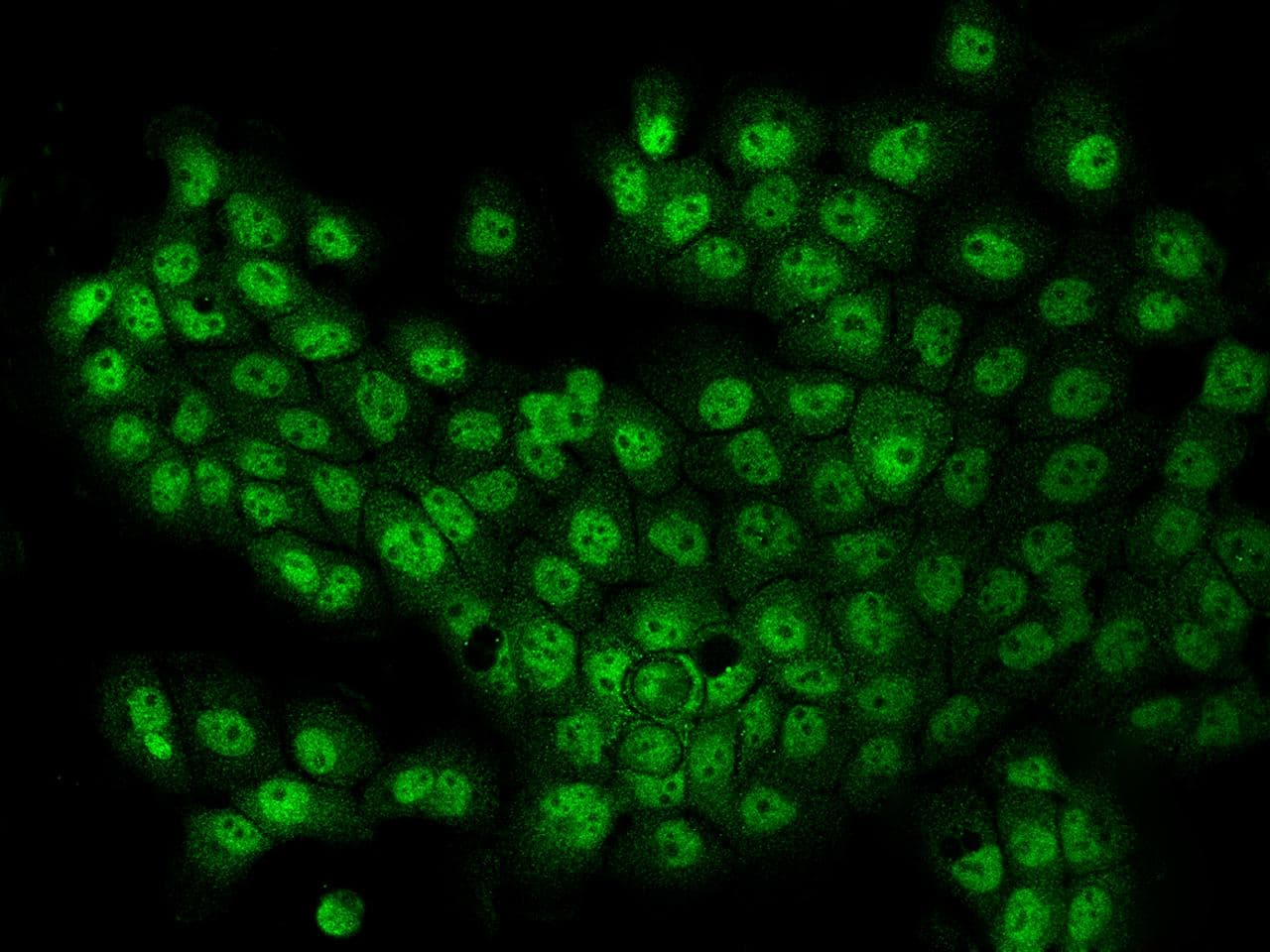TCF4 Antibody