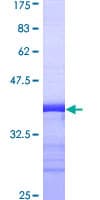 Human FGG / Fibrinogen Gamma Protein (Recombinant GST, N-terminus)