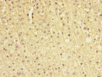 SOCS5 Antibody