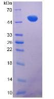 Mouse Vimentin Protein (Recombinant His, N-Terminal)