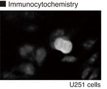 Monoclonal Rat anti-Human Vimentin Antibody (clone TM71, phospho-Ser71, IHC, WB)