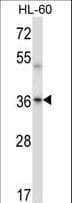 PRKACA + PRKACB Antibody (aa292-319)