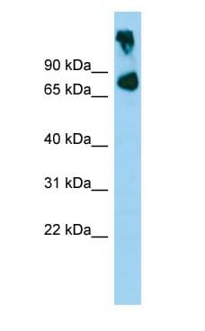 ABCB8 Antibody (aa316-365)