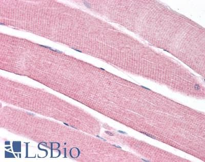 IHC-plus™ SLC16A3 Antibody