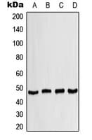 Polyclonal Rabbit anti-Human CSNK1D Antibody (Internal, WB)