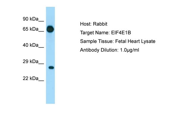 EIF4E1B Antibody (aa20-69)