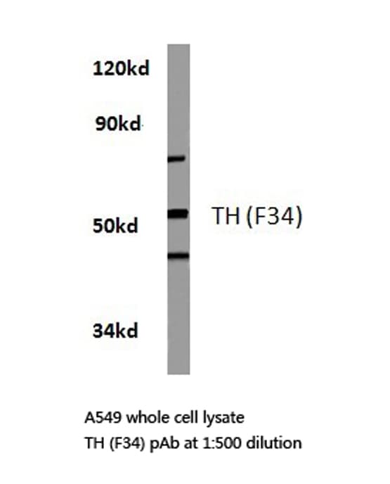 TH / Tyrosine Hydroxylase Antibody (Phe34)