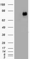 CTNNB1 / Beta Catenin Antibody (clone OTI2D11)