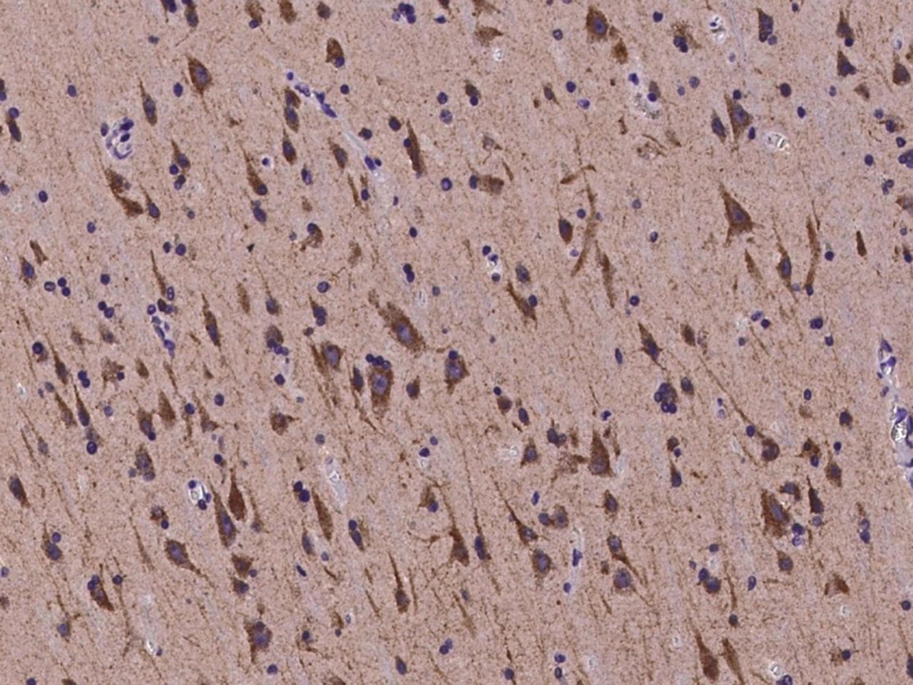 PSK / SEZ6L2 Antibody