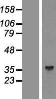 ALDOC / Aldolase C Protein (Over-Expression Lysate Myc-DDK (Flag))