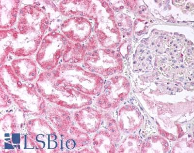 IHC-plus™ CYP1B1 Antibody