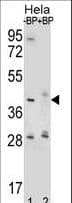 HYAL2 Antibody (aa128-157)