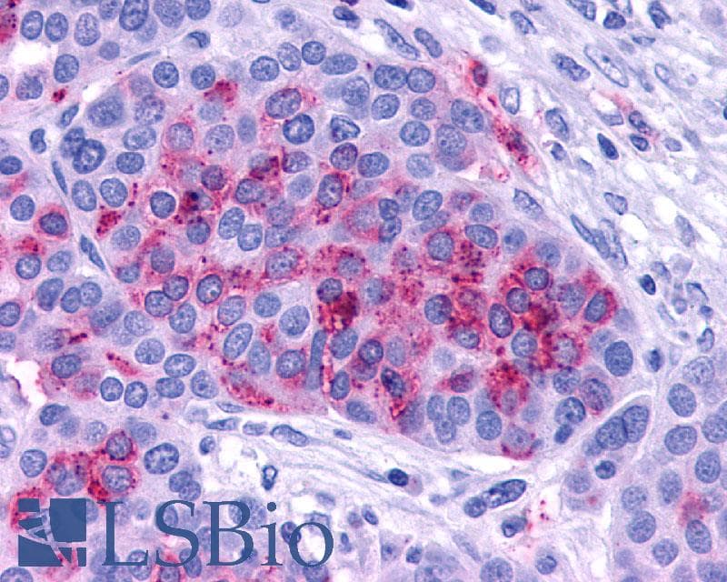 IHC-plus™ ADCYAP1R1 / PAC1 Receptor Antibody (C-Terminus)