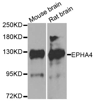 Polyclonal Rabbit anti-Human EPHA4 / EPH Receptor A4 Antibody (WB)