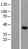 ALDOA / Aldolase A Protein (Over-Expression Lysate Myc-DDK (Flag))