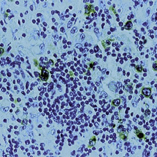 CD30 Antibody (clone Ber-H2)
