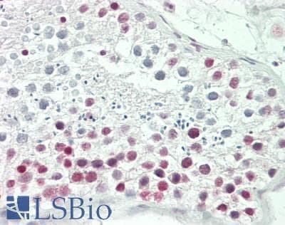 IHC-plus™ SMARCA2 / BRM Antibody (aa100-150)
