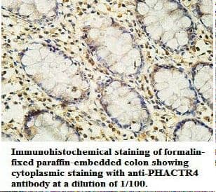 PHACTR4 Antibody (aa139-378)