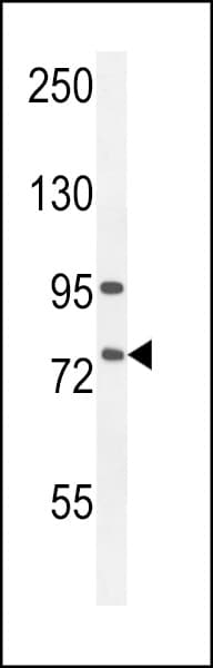 ALOX12B Antibody (aa622-652)
