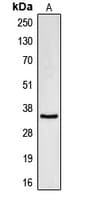 Polyclonal Rabbit anti-Human CDC34 Antibody (Internal, WB)