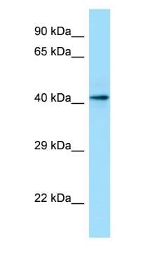 CASQ1 / Calsequestrin 1 Antibody (aa164-213)
