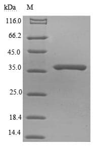 Rabies Virus SARS-CoV Matrix Protein (Recombinant 6His-B2M, N-terminus)