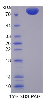 Mouse PCSK9 Protein (Recombinant His-GST)