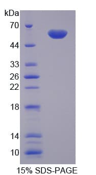 Mouse CTSG / Cathepsin G Protein (Recombinant His-GST)