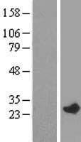 RAB29 / RAB7L1 Protein (Over-Expression Lysate Myc-DDK (Flag))