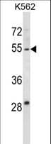 HYAL4 Antibody (aa143-172)
