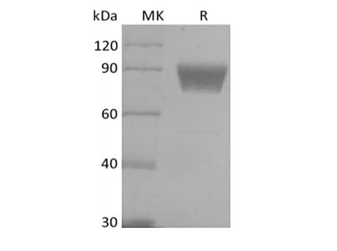 Human VTCN1 / B7-H4 Protein (Recombinant Fc-AVI, C-terminus)