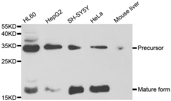 Polyclonal Rabbit anti-Human NGF Antibody (IHC, WB)