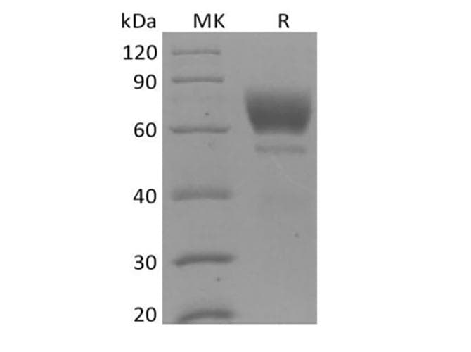 Mouse AXL Protein (Recombinant 6His, C-terminus)