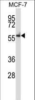 NLK Antibody (aa408-436)