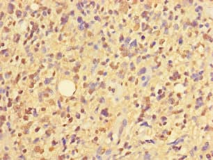 Polyclonal Rabbit anti-Human ZNF559 Antibody