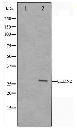 Polyclonal Rabbit anti-Human CLDN2 / Claudin 2 Antibody (IHC, WB)