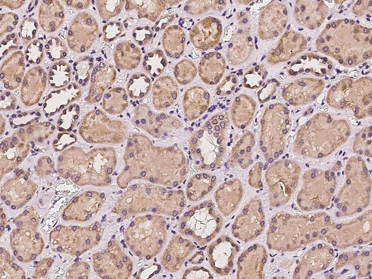 ADAM15 Antibody
