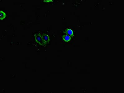 INVS / Inversin Antibody