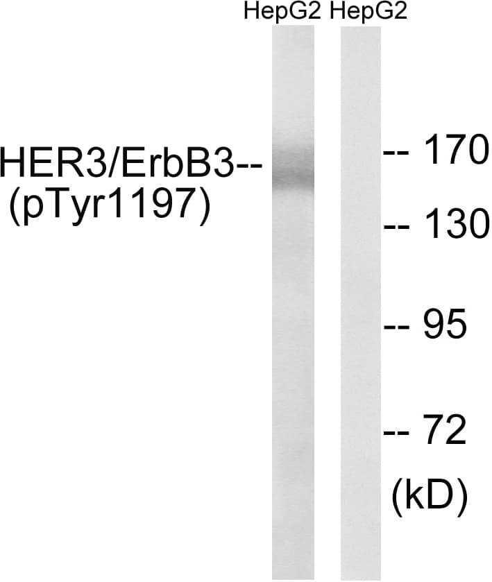 Polyclonal Rabbit anti-Human ERBB3 / HER3 Antibody (phospho-Tyr1197, WB)