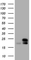 NME1 / NM23 Antibody (clone OTI1D12)