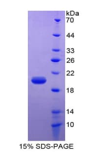 Rat Leptin Protein (Recombinant His-T7)