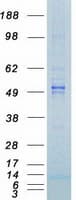 Human GSK3A / GSK3 Alpha Protein (Recombinant Myc-DDK (Flag))