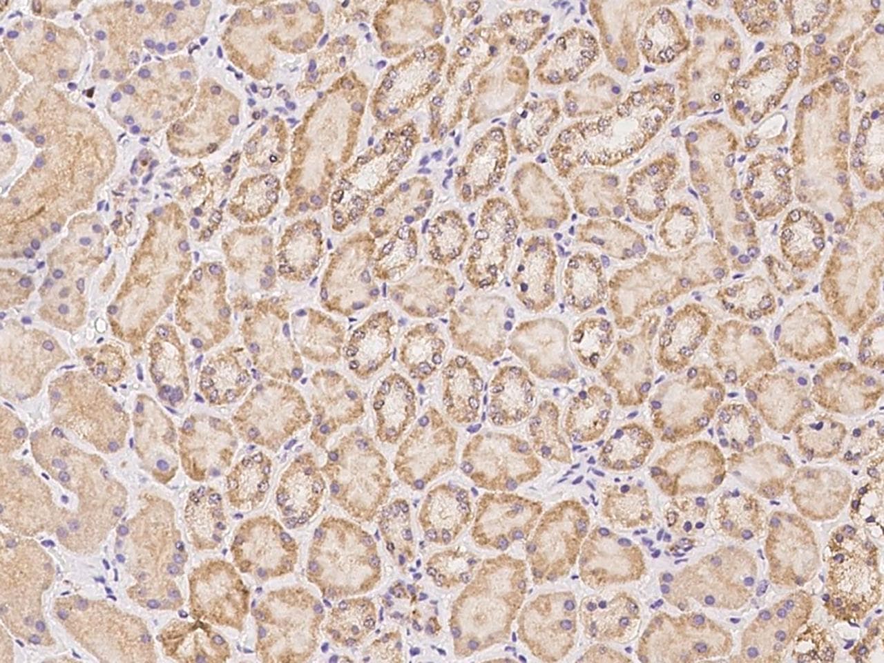 DENND1B Antibody