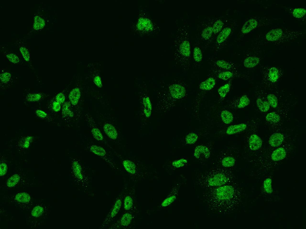 SLCO4C1 Antibody
