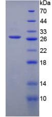 Human PFKP Protein (Recombinant His-T7)