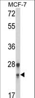 GINS1 / PSF1 Antibody (aa1-30)