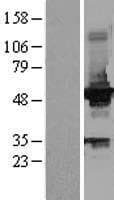 GCK / Glucokinase Protein (Over-Expression Lysate Myc-DDK (Flag))